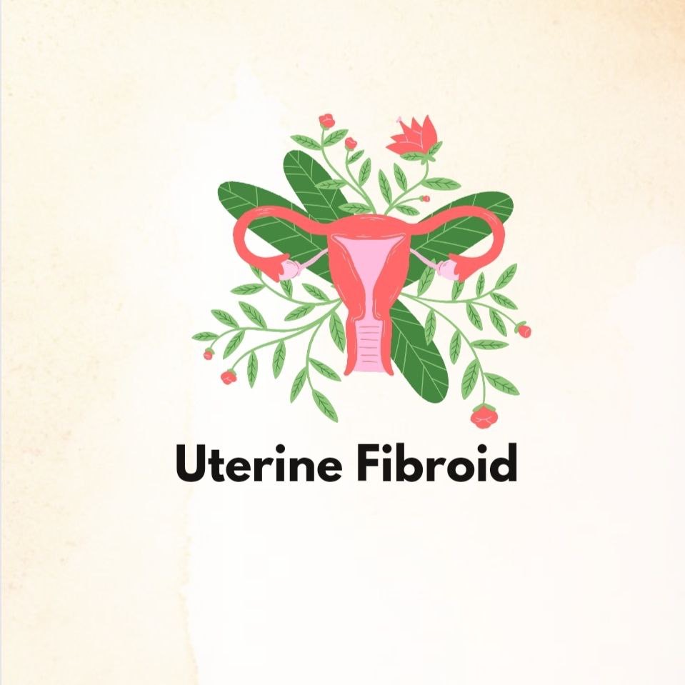 Uterine Fibroid – Types, Locations, Causes, Diagnosis,  Medical Treatments and Their Surgeries